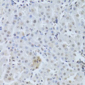 Polyclonal Rabbit anti-Human CDK4 Antibody (IHC, IF, WB)