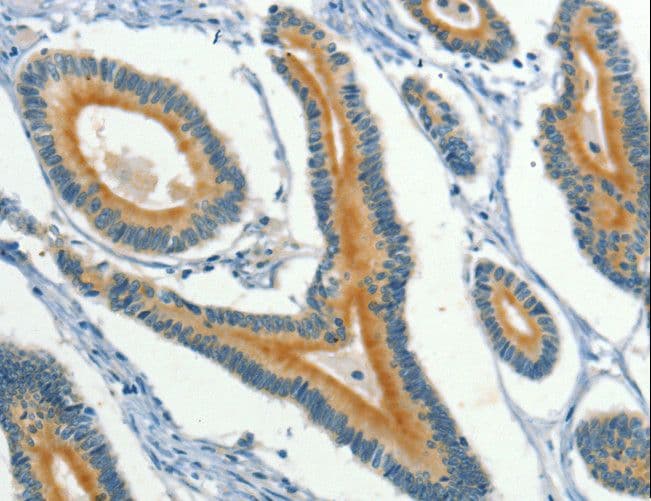 KLC1 / Kinesin Light Chain 1 Antibody