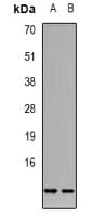 Histone H4 Antibody (Acetyl-Lys5)