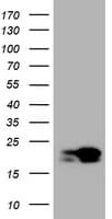 NME1 / NM23 Antibody (clone OTI1C11)