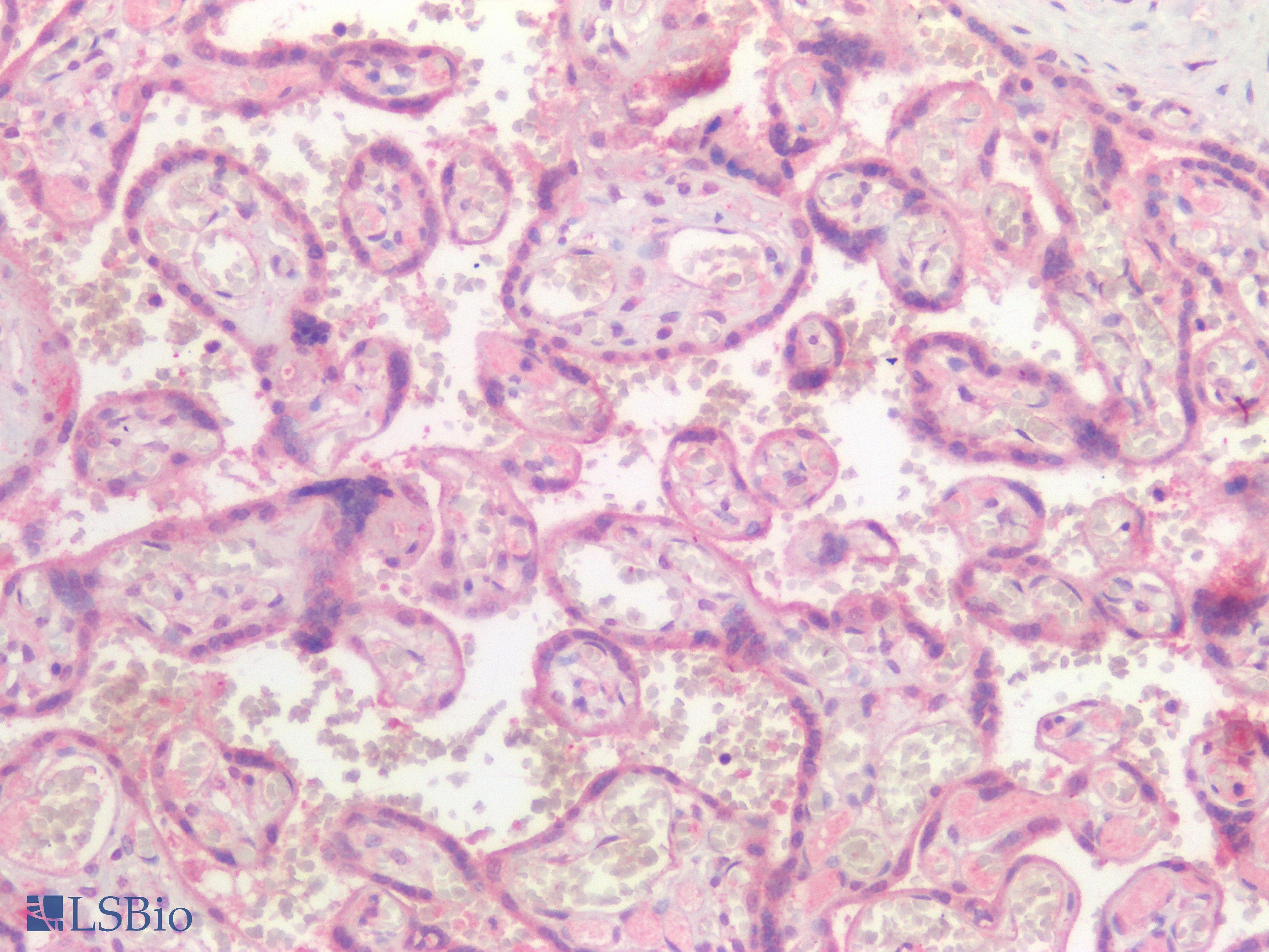 IHC-plus™ Polyclonal Rabbit anti-Human TNFRSF1B / TNFR2 Antibody (IHC)