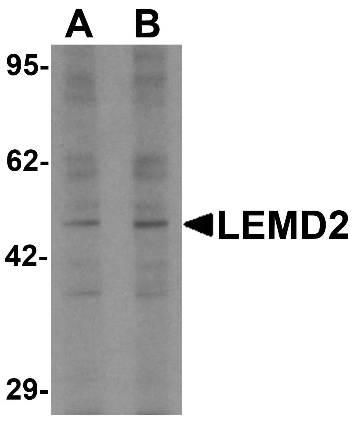 IHC-plus™ LEMD2 Antibody