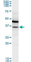 IHC-plus™ Monoclonal Mouse anti-Human MDH / MDH2 Antibody (clone 1G12, IHC, WB)