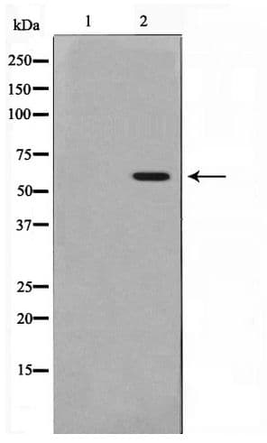 MAPKAPK5 / PRAK Antibody (phospho-Thr182)