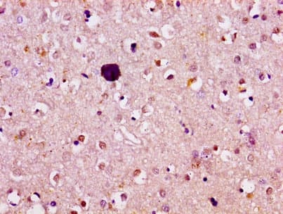 ATL1 Antibody