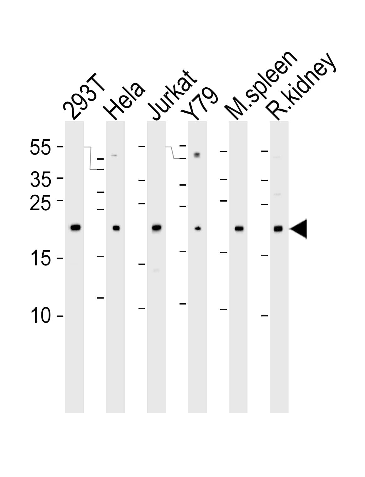 DHFR Antibody (aa16-30)
