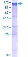 Human OSBPL3 Protein (Recombinant GST)