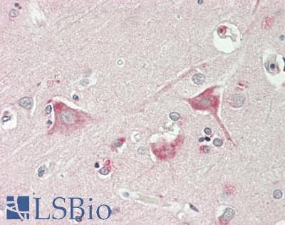 IHC-plus™ Polyclonal Rabbit anti-Human KCNJ16 / Kir5.1 Antibody (aa376-428, IHC, IF, WB)