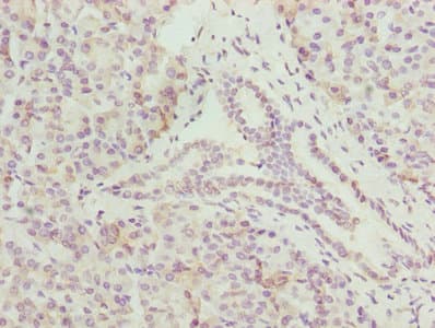 CMC1 Antibody