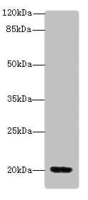 Polyclonal Rabbit anti-Human MSRB2 / MSRB Antibody (IHC, WB)