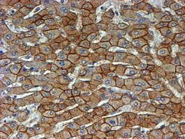 CTNNB1 / Beta Catenin Antibody (clone OTI3F9)