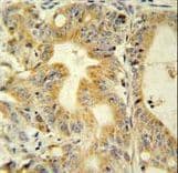 TNFRSF6B / DCR3 Antibody (aa22-48)