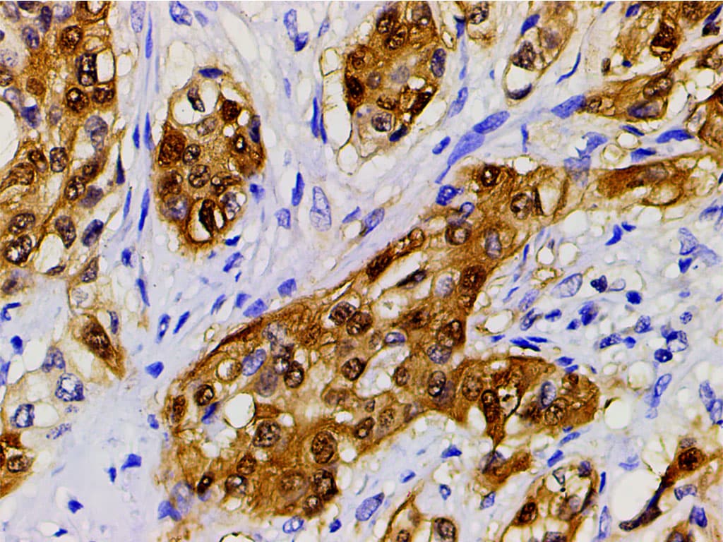 CFL1 / Cofilin Antibody (phospho-Ser3)