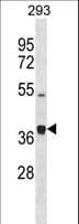 Polyclonal Rabbit anti-Human PCOLCE2 Antibody (aa201-230, WB)