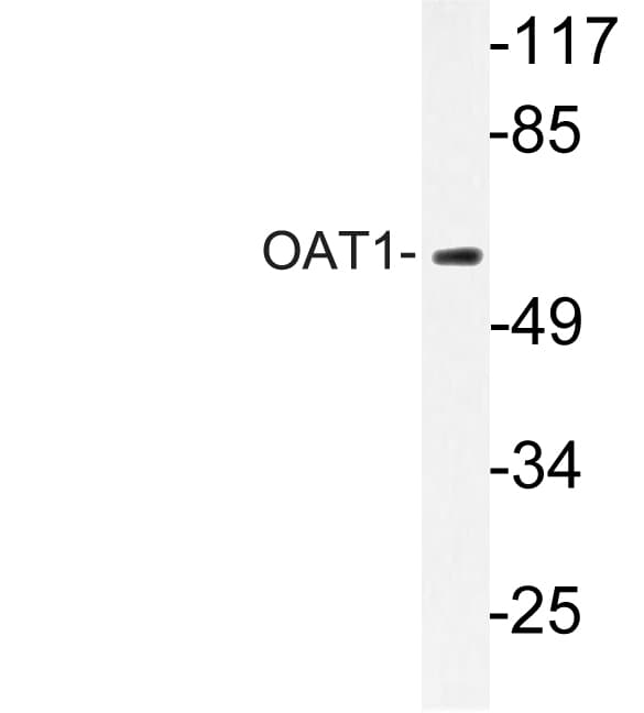 SLC22A6 / OAT1 Antibody (aa255-304)