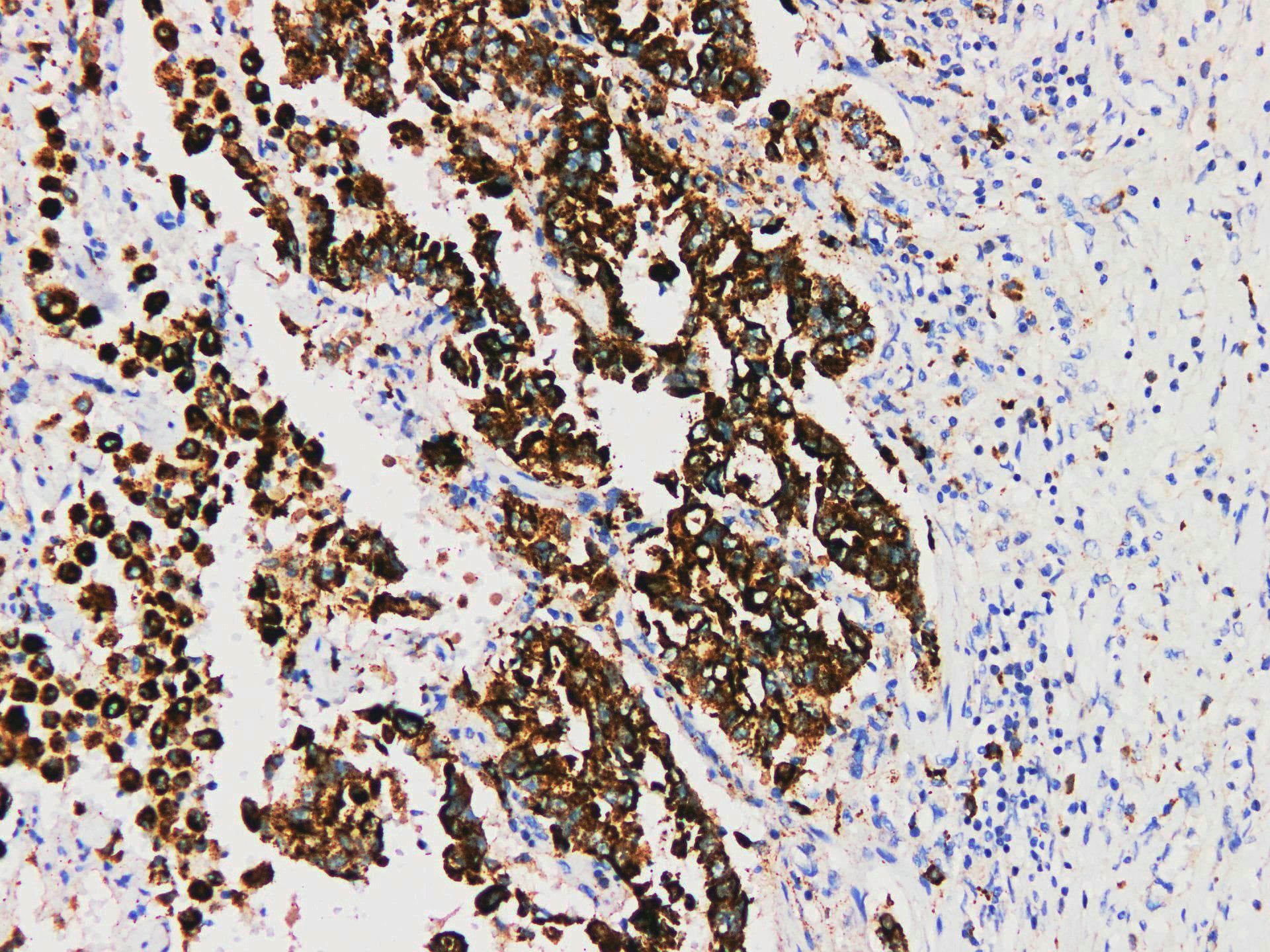 NAPSA / NAPA / Napsin A Antibody