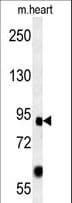 Polyclonal Rabbit anti-Human FOXP2 Antibody (aa657-684, IF, WB)