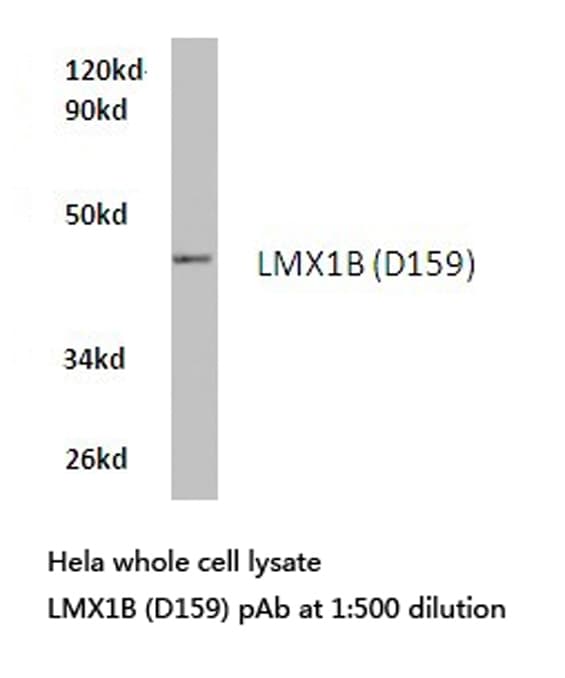 Polyclonal Rabbit anti-Human LMX1B Antibody (Asp159, IHC, WB)
