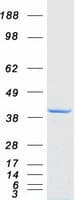 Human ZNF397 Protein (Recombinant Myc-DDK (Flag))