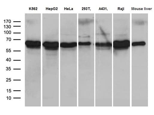 Monoclonal Mouse anti-Human AIFM1 / AIF / PDCD8 Antibody (clone OTI4E6, aa134-483, IHC, WB)