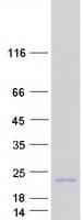 Human CNIH3 Protein (Recombinant Myc-DDK (Flag))