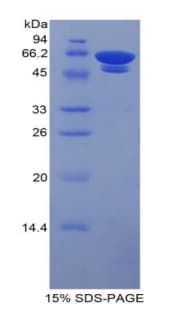 Human HbA1c / Hemoglobin a1c Protein (Native)