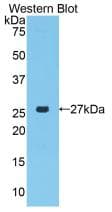 PRTN3 / Myeloblastin Antibody (aa24-249)