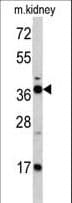 IHC-plus™ FBP1 Antibody (aa125-156)
