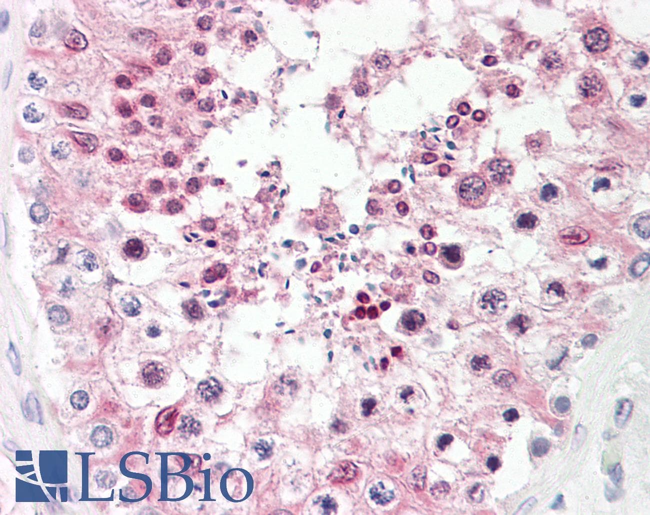 IHC-plus™ Monoclonal Mouse anti-Human CSNK2A1 Antibody (IHC, WB)
