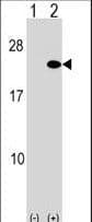 Polyclonal Rabbit anti-Human ARF5 Antibody (aa80-108, WB)