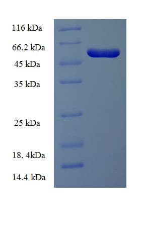 Human ILKAP Protein (Recombinant His-SUMO)