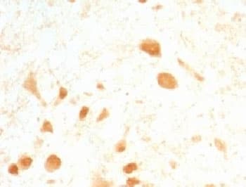 UCHL1 / PGP9.5 Antibody (clone UCHL1/775)