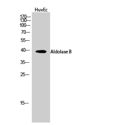 ALDOB Antibody (80-160 aa, Internal)