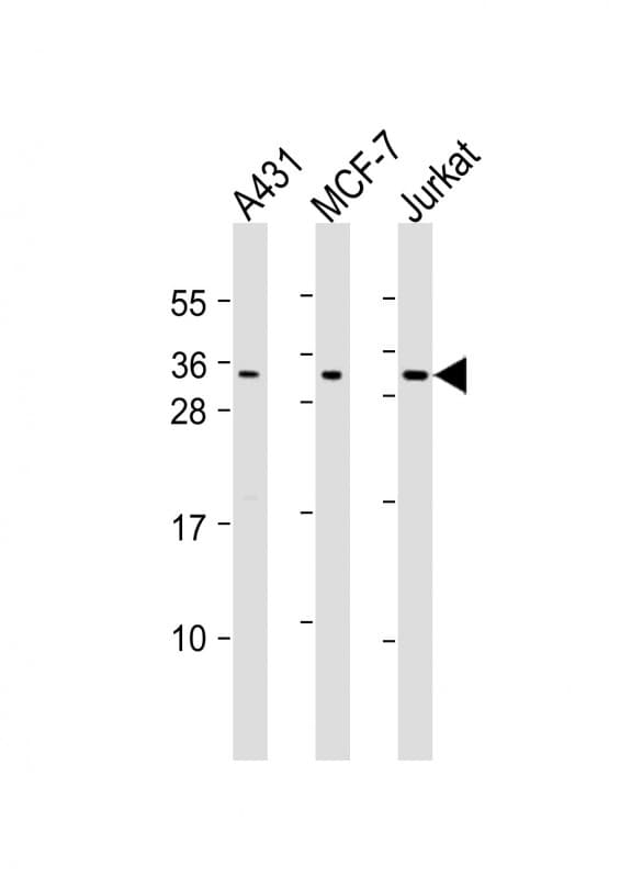 CASP14 / Caspase 14 Antibody (aa59-93)