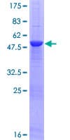Human TNFSF11 / RANKL / TRANCE Protein (Recombinant GST)