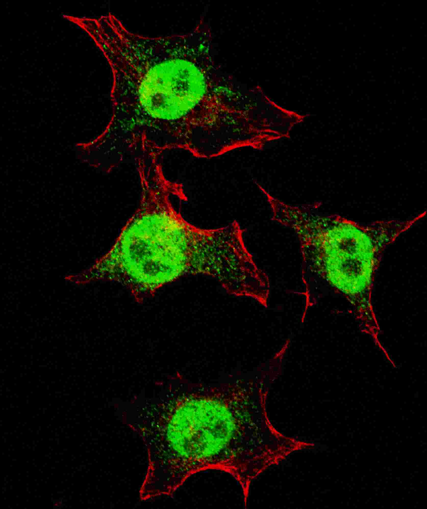 IHC-plus™ ITGA6/Integrin Alpha 6/CD49f Antibody (aa1043-1072)