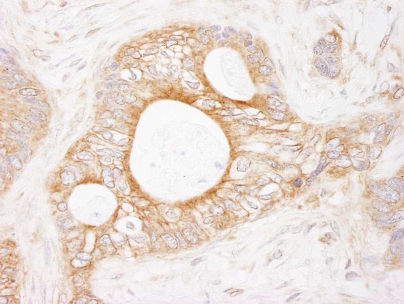 Polyclonal Rabbit anti-Human EEF2K Antibody (aa1-50, IHC, WB)