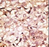 IHC-plus™ ACE2 / ACE-2 Antibody (aa773-805)