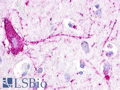 PathPlus™ GPR12 Antibody (Extracellular Domain)