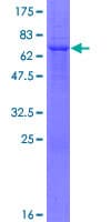 Human ZNF396 Protein (Recombinant GST)