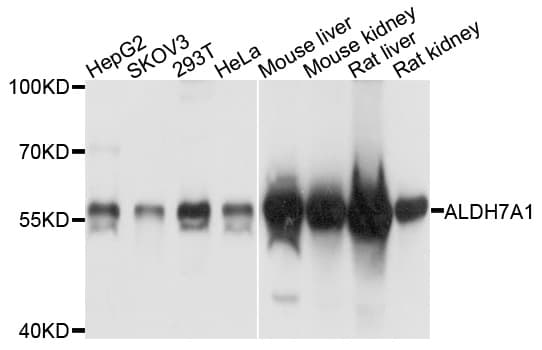 ALDH7A1 Antibody