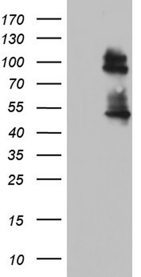 Monoclonal Mouse anti-Human GLI / GLI1 Antibody (clone OTI4C8, aa755-1106, WB)