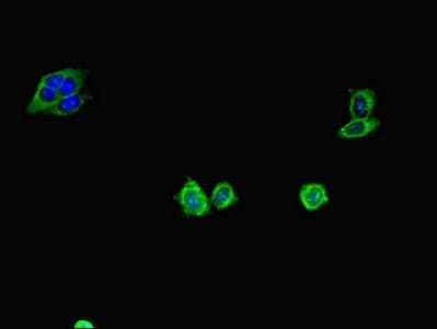 Polyclonal Rabbit anti-Human CD34 Antibody (IHC, IF, WB)