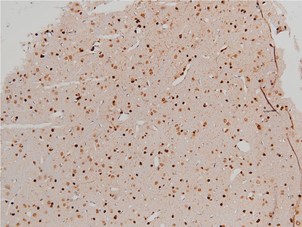 CFL1 / Cofilin Antibody (phospho-Ser3)