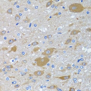 EIF2S3 / EIF2G Antibody