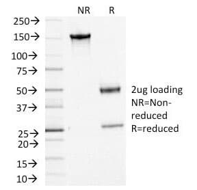 Monoclonal Mouse anti-Human ACTH Antibody (clone CLIP/1449, IHC, IF)