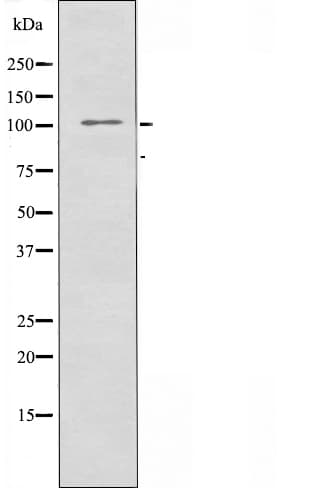 DSG1 / Desmoglein 1 Antibody