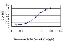 PRKCA / PKC-Alpha Antibody (clone 2F11)