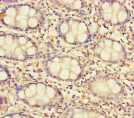 T2R13 / TAS2R13 Antibody