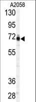 PAPSS 1 Antibody (aa592-624)